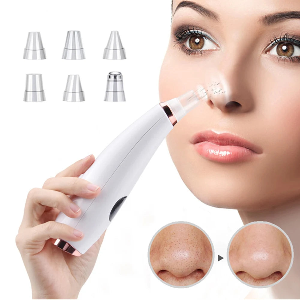 Eliminador Eléctrico de Espinillas y Acné, Limpiador de Poros al Vacío, Máquina para Quitar Puntos Negros, Limpieza Facial Profunda, Herramienta de Cuidado de la Piel