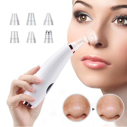Eliminador Eléctrico de Espinillas y Acné, Limpiador de Poros al Vacío, Máquina para Quitar Puntos Negros, Limpieza Facial Profunda, Herramienta de Cuidado de la Piel